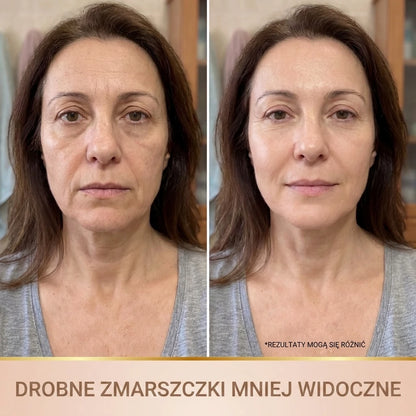 Efekt przed i po z mniej widocznymi drobnymi zmarszczkami