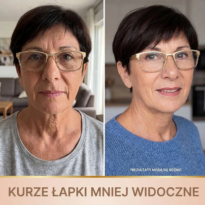 Efekt przed i po z mniej widocznymi kurzymi łapkami