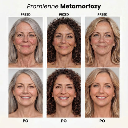 Promienne metamorfozy